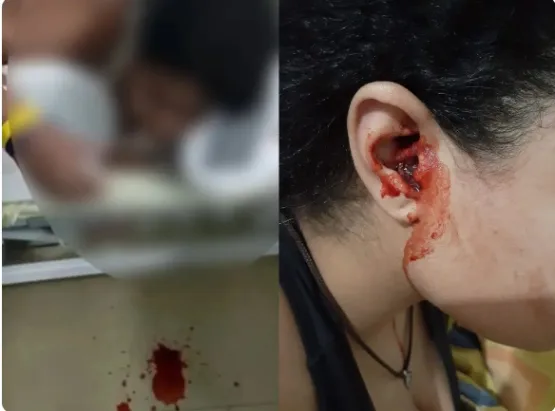 Jovem que sangrava pelo nariz, boca e ouvidos agora 'chora' sangue: 'Assustador', diz mãe