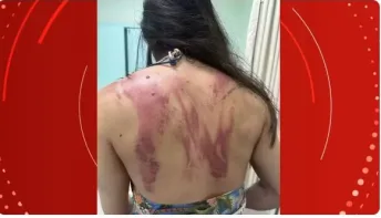'Seria meu último dia', diz mulher que quase foi morta pelo próprio pai