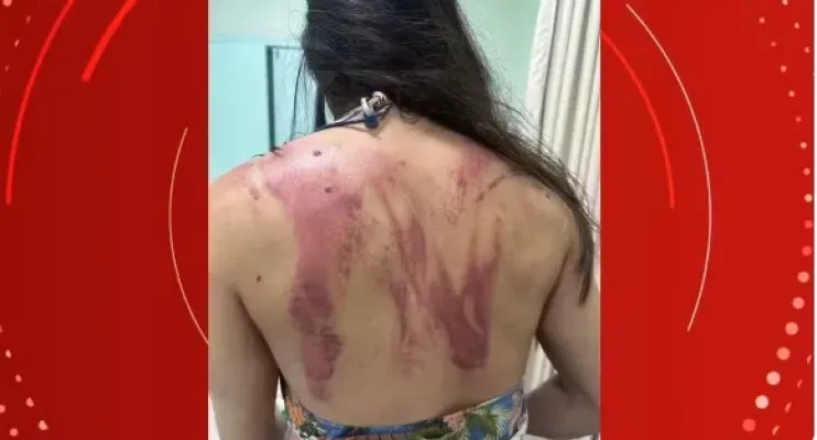 'Seria meu último dia', diz mulher que quase foi morta pelo próprio pai