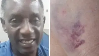  'Como eu iria chamar a polícia se ele é a polícia e estava armado?’, indaga vítima agredida por ex em delegacia