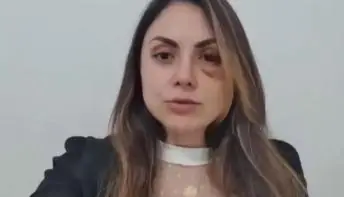 'Igualdade ainda não é respeitada', afirma procuradora espancada