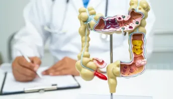 5 curiosidades que precisa saber sobre doenças inflamatórias intestinais