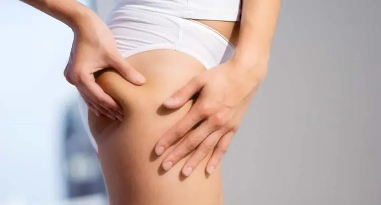 7 alimentos que ajudam a amenizar a celulite