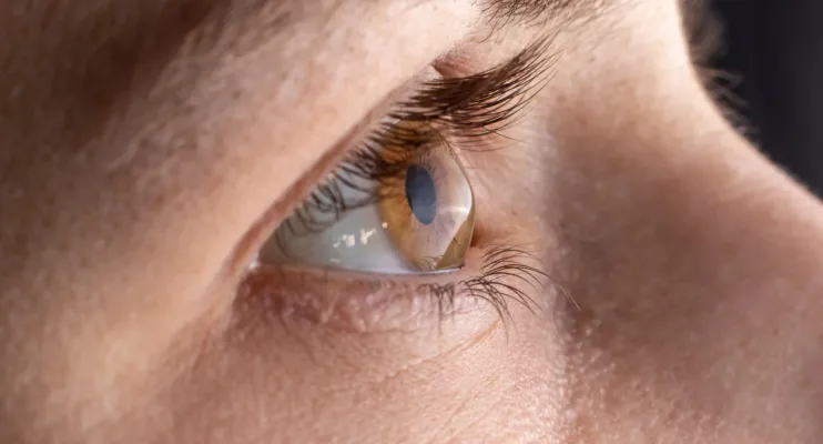 9 mitos e verdades sobre como preservar a saúde dos olhos