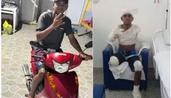 Adolescente tem braços, perna e parte de pé amputados após levar choque