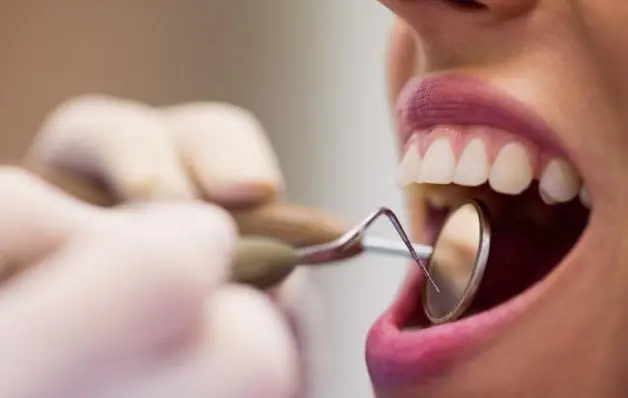 Câncer de boca: acompanhamento odontológico é fundamental para prevenção e diagnóstico precoce