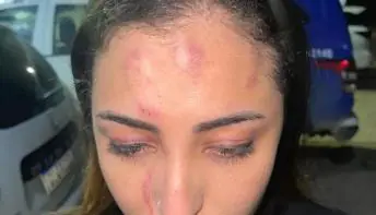 Cantora é espancada por PM, que estaria bêbado, e pela mulher dele antes de show em PE;