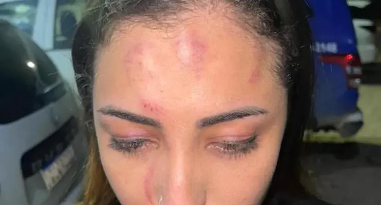 Cantora é espancada por PM, que estaria bêbado, e pela mulher dele antes de show em PE;