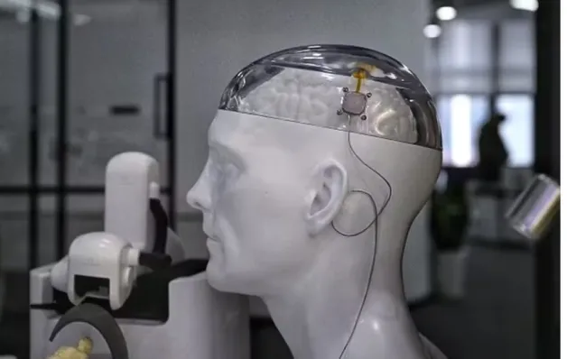 China comercializa 1º implante cerebral; tecnologia liga sistema nervoso a dispositivo externo
