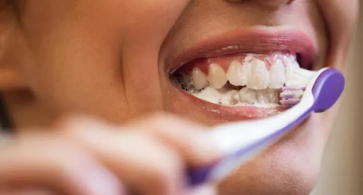 Cirurgiã dentista fala sobre 6 hábitos que causam malefícios para os dentes