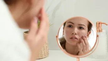 Como distinguir acne hormonal de acne causada pelo stress