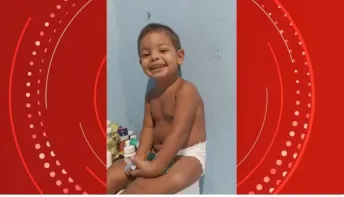  Criança de 2 anos derruba panela com água fervendo e tem 60% do corpo queimado