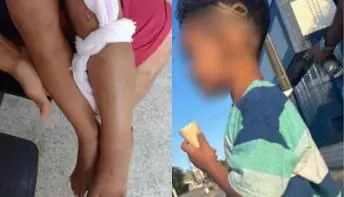 Criança é mordida por cobra e vai para UTI após confundir animal com galho