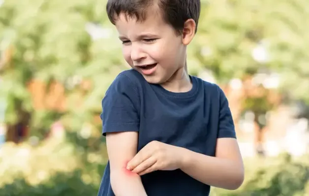 Criança quase morre após coçar picada de mosquito; entenda o que aconteceu
