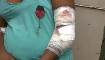 Criminoso atira em carro e fere eletricista e filha no ES; neto de 1 ano estava no colo