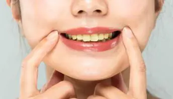 Dentes manchados? Evite estes cinco alimentos