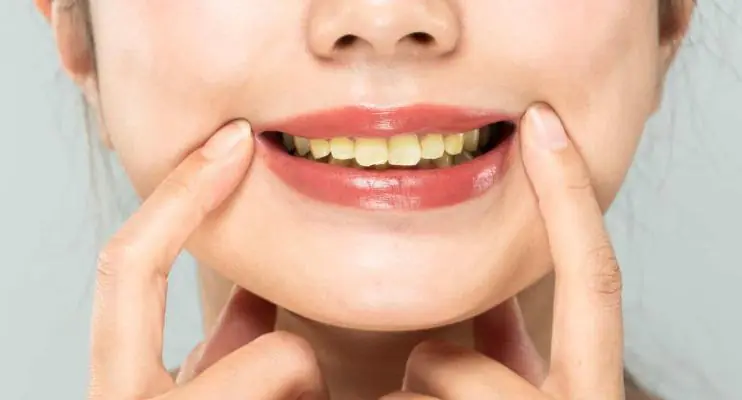 Dentes manchados? Evite estes cinco alimentos