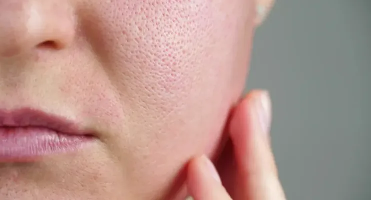 Dermatologistas revelam alimentos que afetam o colágeno e aceleram o envelhecimento da pele
