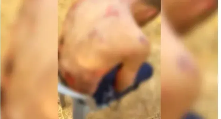 Dono de mercado e mais 3 são presos por atear fogo e espancar homem que furtou sandália