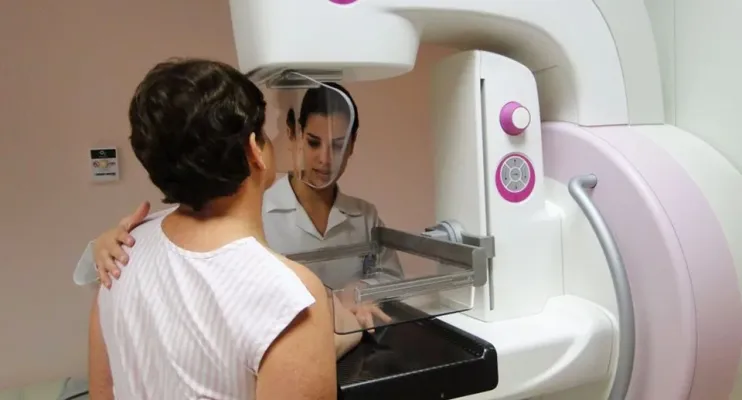 Espírito Santo amplia mamografia de rastreamento a todas mulheres a partir dos 40 anos