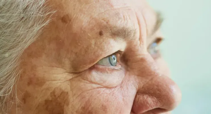 Estudo revela relação entre carnitina e risco de Alzheimer em mulheres