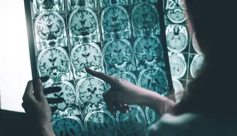Exame de sangue para diagnóstico de Alzheimer chega ao Brasil