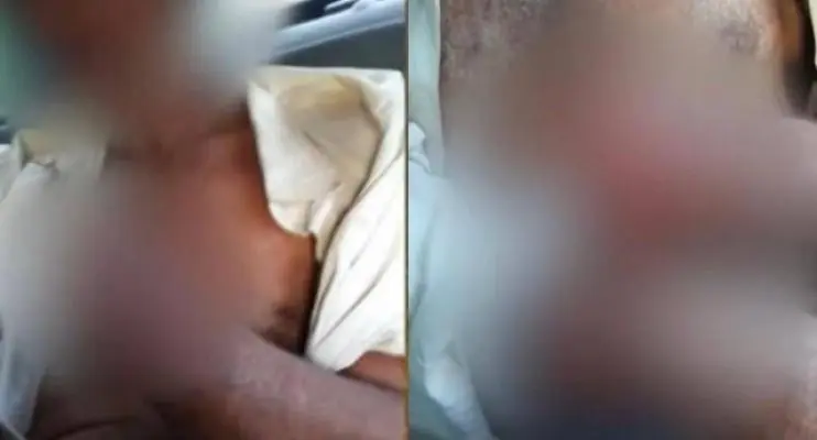 Fazendeiro decepa mão de funcionário que não recebeu salário e furtou galinha