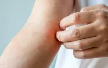 Fungo sexual acende alerta sanitário internacional