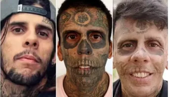 Homem 'mais tatuado do Brasil' começa a remover tatuagens; saiba o motivo