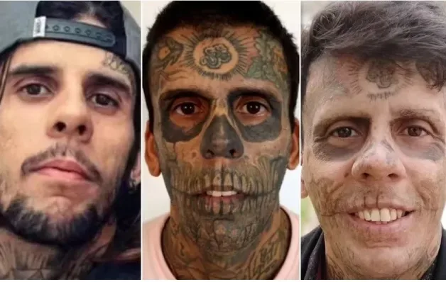 Homem 'mais tatuado do Brasil' começa a remover tatuagens; saiba o motivo