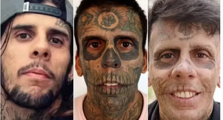 Homem 'mais tatuado do Brasil' começa a remover tatuagens; saiba o motivo