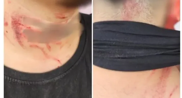 Homem é preso suspeito de estuprar, agredir e roubar amigo da namorada