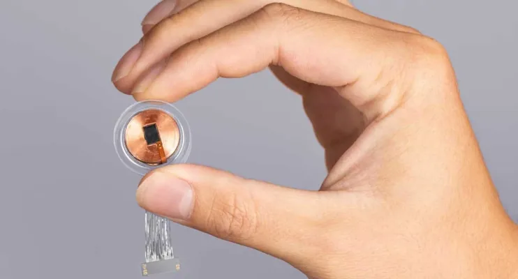Humano recebe primeiro implante de chip cerebral de empresa de Elon Musk