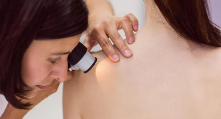 SESA Neste sábado (11), a Saúde da Serra promoverá o 1º Plantão Dermatológico do ano