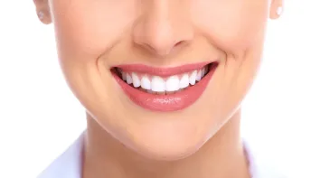 Implante dentário: 6 principais dúvidas esclarecidas