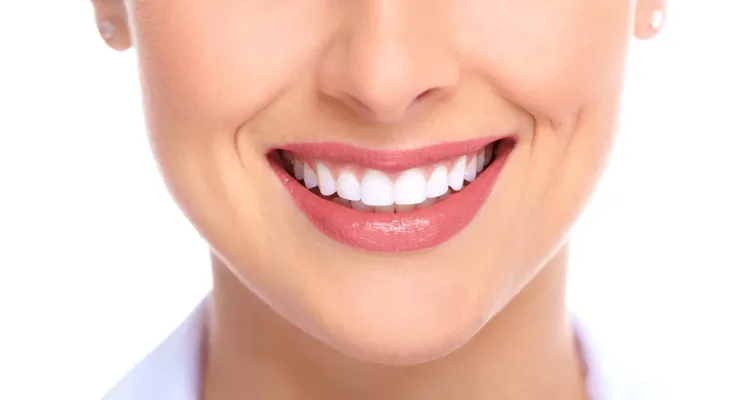 Implante dentário: 6 principais dúvidas esclarecidas