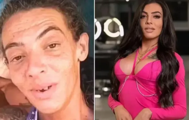 Influenciadora que viveu nas ruas faz 10ª cirurgia e impressiona