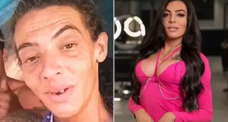 Influenciadora que viveu nas ruas faz 10ª cirurgia e impressiona