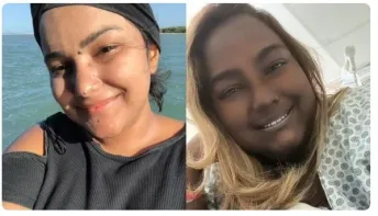 Jovem com tumor raro que alterou cor da pele deixa UTI e aguarda melhora para receber medicação