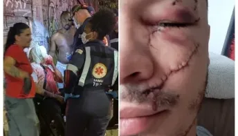 Jovem leva mais de 30 pontos no rosto após ser agredido com garrafa em bar