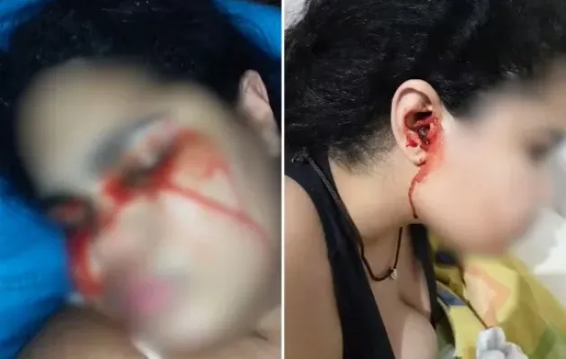 Jovem que sangrava pelo nariz, boca e ouvidos agora 'chora' sangue: 'Assustador', diz mãe