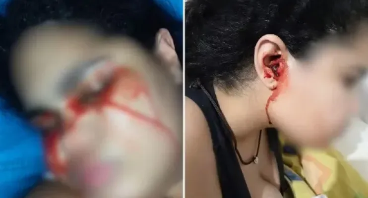 Jovem que sangrava pelo nariz, boca e ouvidos agora 'chora' sangue: 'Assustador', diz mãe