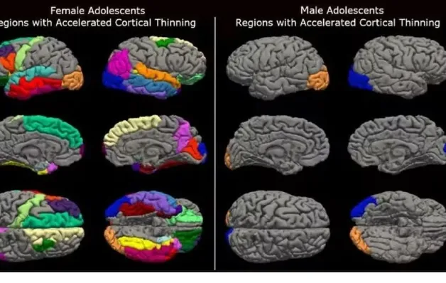  Lockdown acelerou envelhecimento cerebral das adolescentes em até 4 anos