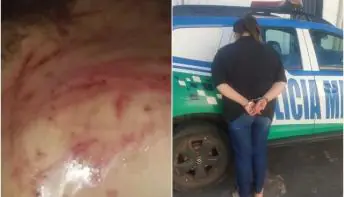 Mãe é presa suspeita de torturar filha de 8 anos com cipó por ela 'fazer bagunça'