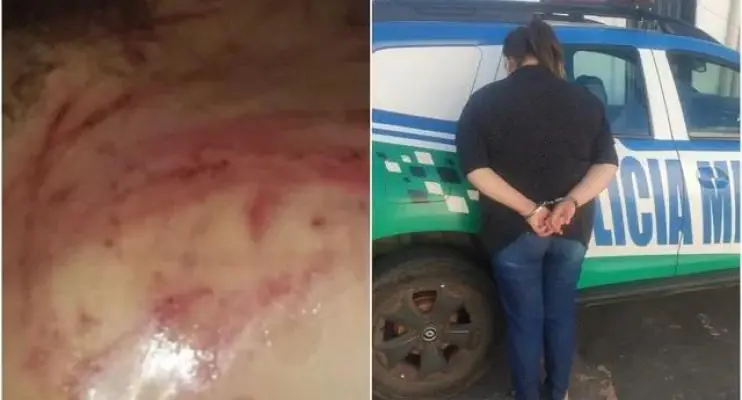 Mãe é presa suspeita de torturar filha de 8 anos com cipó por ela 'fazer bagunça'