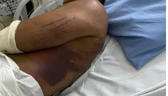 Militares são denunciados por torturar por 3 dias e tentar matar major da PM durante curso do Bope