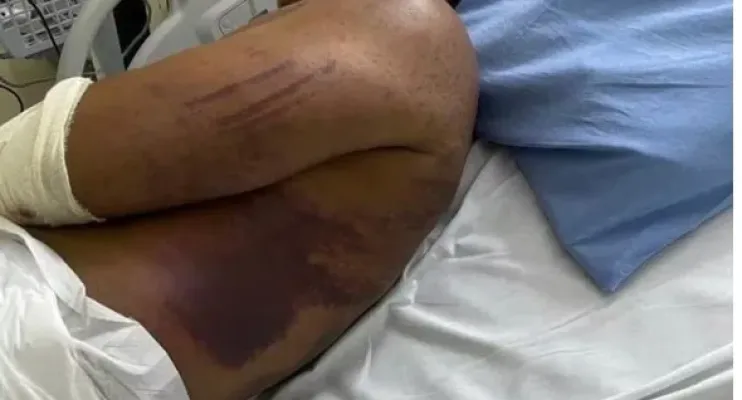 Militares são denunciados por torturar por 3 dias e tentar matar major da PM durante curso do Bope