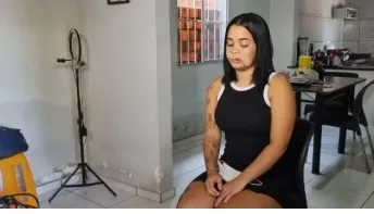 Modelo tenta beijar cachorro na boca e tem parte do lábio arrancado por mordida