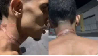  Motoboy sofre queimaduras no pescoço após se enrolar em fios soltos em Cariacica