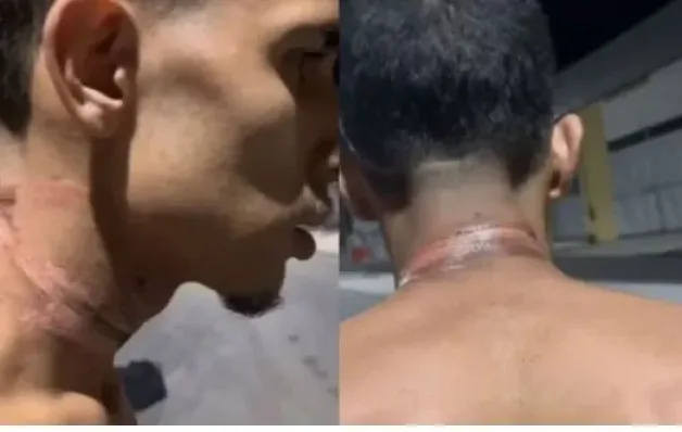  Motoboy sofre queimaduras no pescoço após se enrolar em fios soltos em Cariacica